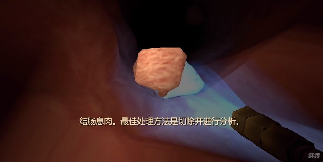 大肠的复仇(Revenge Of The Colon) 大肠的复仇(Revenge Of The Colon)