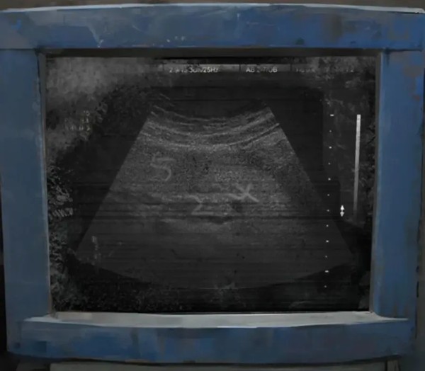 纸嫁衣8千子树第一章攻略图